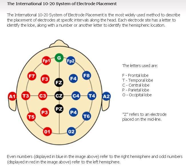 electrode_placement.jpg